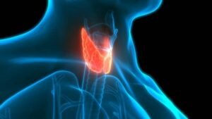 Expert Thyroid Cancer Treatment in Vaishali