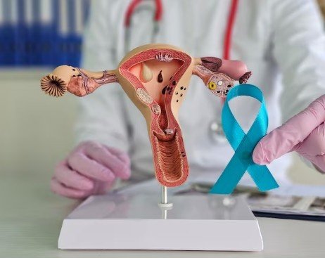 Best Gynecological Cancer Treatment in Vaishali