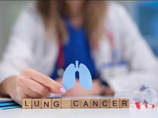Best Lung Cancer Treatment in Vaishali