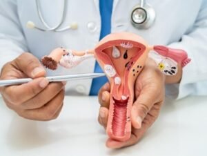 Best Gynecological Cancer Treatment in Vaishali