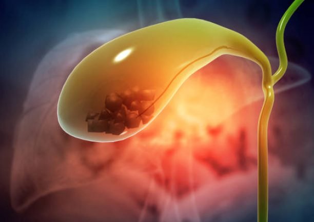 Gallbladder with stone. 3d illustration